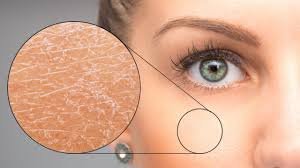 7 Ways to heal dry Skin.