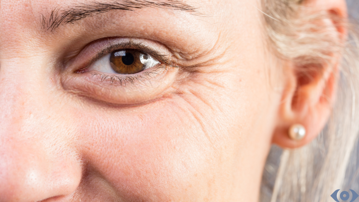 How to eliminate fine lines and wrinkles.