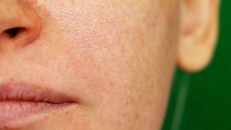 12 Effective Tips for Enlarged Pores Treatment