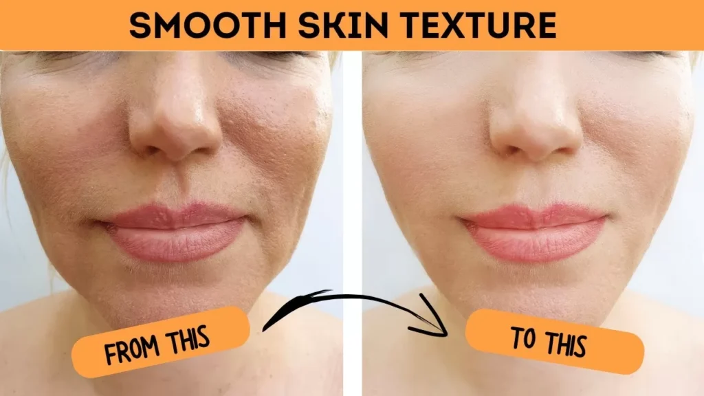 How to Achieve Smooth Skin 